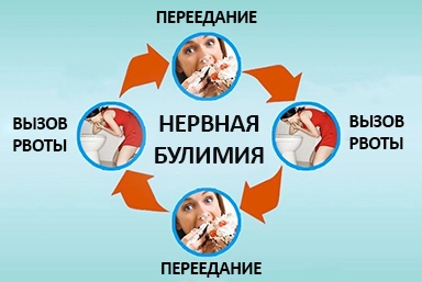 Лечение булимии в Усолье-Сибирском
